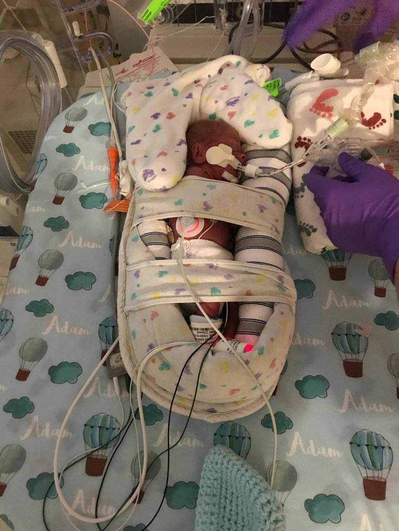 adam early NICU.jpg