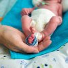 Law requiring insurance to cover donated breastmilk gives preemies ‘best possible chance’