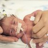JFL becomes first US Virgin Islands hospital to adopt Prolacta protocol for extremely premature NICU babies